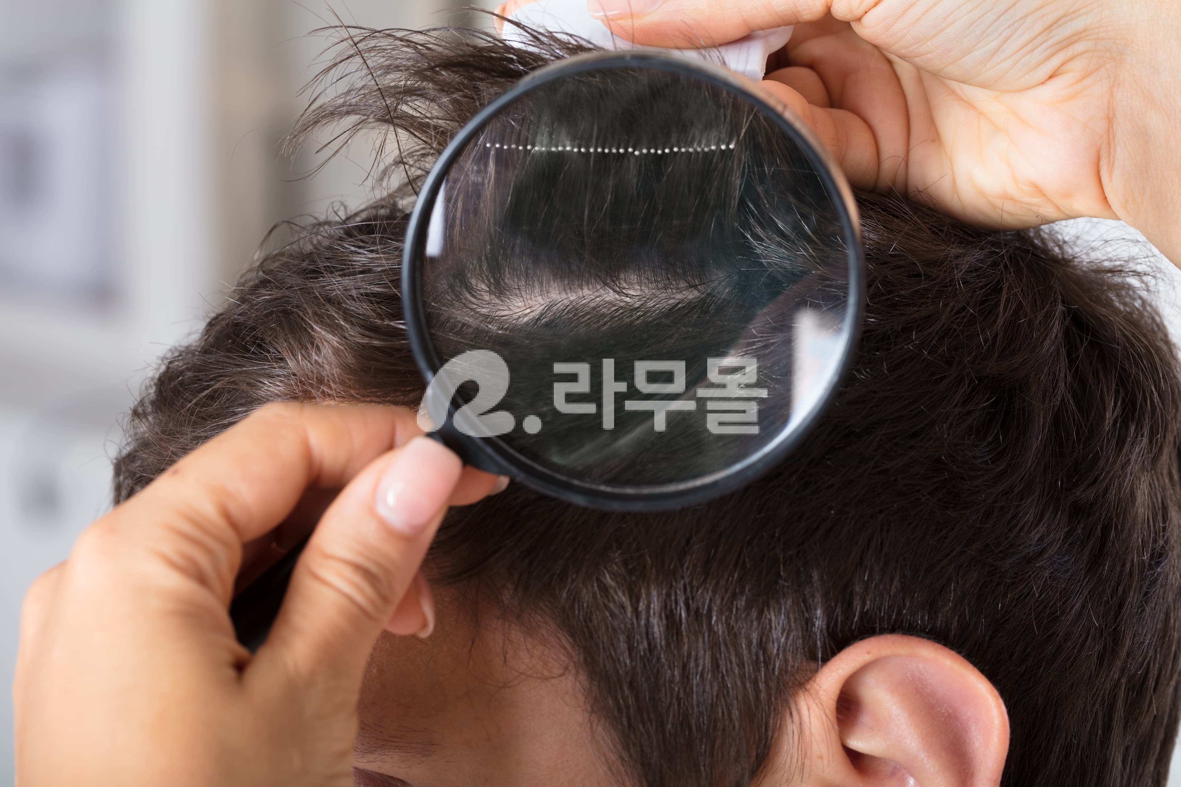 아보다트 두타놀 500정 직구 후기